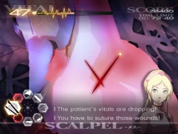 Скриншот к игре Trauma Center: Second Opinion