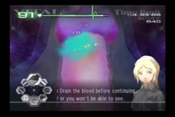 Скриншот к игре Trauma Center: Second Opinion